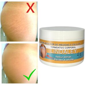Creme Anti Estrias Removedor de Estrias 300g Lindaley Resultados Reais