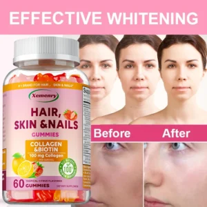 Gomas para Cabelo, Pele e Unhas - Antioxidante Poderoso, Melhora a Luminosidade da Pele, Promove o Crescimento do Cabelo, Unhas Fortes e Pele Saudável